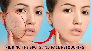 Cleaning Face Spots and Face Retouching in Photoshop