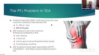 Patellar Resurfacing in TKA