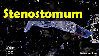 Maybe some kind of flatworm Stenostomum