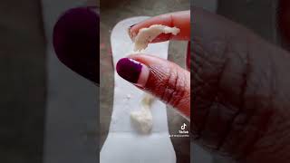 White vaginal discharge? #yeastinfection #thrush #fungalinfection #youtubemadeforyou