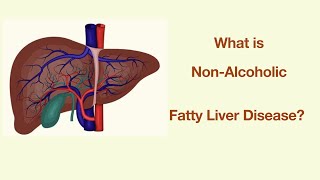 Non-Alcoholic Fatty Liver Disease