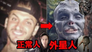 【恐怖故事】35歲男子瘋狂做人體改造 '黑色外星人'，殘忍換臉手術要切鼻子及割耳朵！原來他前世是蜥蜴人？