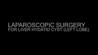 Hydatid cyst Liver: Laparoscopic Surgery I Dr Atul Mishra