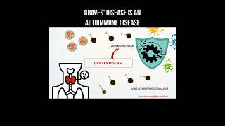 Graves disease is an autoimmune disease #basedow #gravesdisease #autoimmunedisease #thyroid