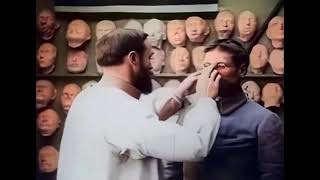 Prosthetics being fitted to a wounded WW1 soldier in 1918