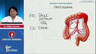 PI24   CIRUGÍA GENERAL   Abdomen agudo vascular  Isquemia intestinal crónica