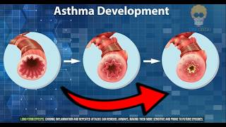 Астма: Исследование ее развития (Анимация)