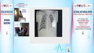 Autosomal Recessive Long QT Syndrome In eyptian Families   Dr  Mohamed El Maghawry