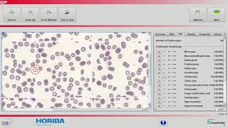 Horiba Medical QSP expert classification with voice