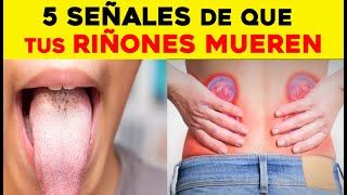 5 señales de que tus riñones necesitan ayuda urgente