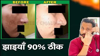 90% theek ho gaya - Dr Prateek Chauhan