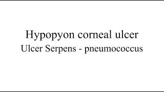 Hypopyon corneal ulcer | ophthalmology mbbs