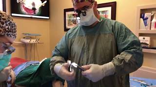 SAME DAY TEETH with 6 Dental Implants using Guided Surgery