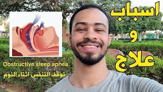 توقف التنفس اثناء النوم - اسباب وعلاج - (مفاجأة في النهاية) - Obstructive sleep apnea