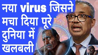 नया virus जिसने मचा दिया पूरे दुनिया में खलबली WHO Declares Global Health EMERGENCY _ Mpox spreads