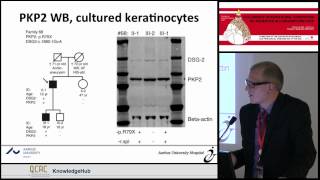 T B  Rasmussen - The majority of plakophilin-2 mutations in ARVC are associated...