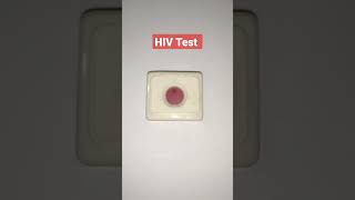 hiv test #shorts