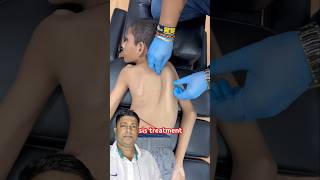 Scoliosis treatment #chiropractic #chiropractickalyan #chiropractor #physiotherapy #satisfying