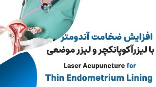 درمان ضخامت کم آندومتر و بارداری طبیعی --- Acupuncture for Thin Endometrium Lining