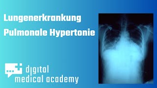 Lungenerkrankung Pulmonale Hypertonie