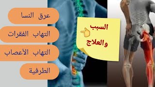 عرق النسا والدسك والالتهابات الأعصاب هذه هي الأسباب واحدث علاج لهم 👍