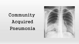 Community Acquired Pneumonia