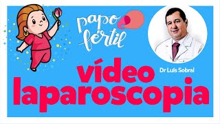 Videolaparoscopia | Dr Luiz Sobral | Papo Fértil LIVE