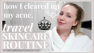 The Current Skincare Routine that CLEARED my Acne!