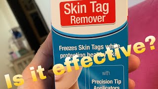 HOW TO REMOVE SKIN TAG PERMANENTLY?