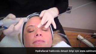 Hydrafacial Akne Leke Yüz Temizleme Cilt Yenileme