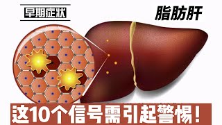 脂肪肝早期症状解析！这10个信号需引起警惕！@168Health