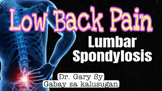 Lumbar Spondylosis: Causes, Symptoms, Self-Help & Treatment - Dr. Gary Sy