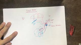 Facial Nerve Palsy, SACD, ALS, Occulomotor Nerve Compression