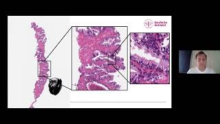 Leveraging supercomputers for data-driven life science research: examples from Berzelius