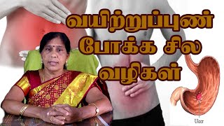 வயிற்றுப்புண் போக்க சில வழிகள் | Dr.V.Rathinam. BSMS