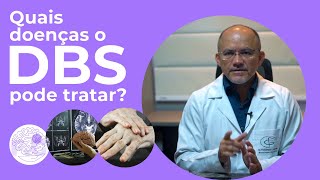 DBS para Parkinson: Conheça a Estimulação Cerebral Profunda para Parkinson com Dr. Francinaldo Gomes