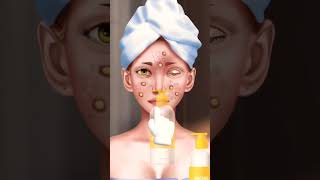 Face Acne Removing | Surgery Process | Medical Life #surgeon