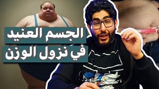 الجسم العنيد في نزول الوزن في الدايت