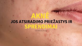 Pakalbėkime apie odą #2 Aknės atsiradimo priežastys ir sprendimai