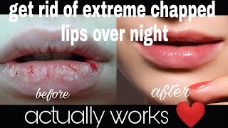 Get rid of chapped lips in just 1 day (really works) | Diy lip scrub | easy and homemade lip scrub