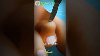 #طب_وعلوم #shortvideo #shortsfeed #shortyoutube #shortsvideo #السعودية