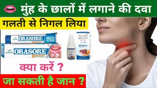 गलती से छाले की दवा निगलने से क्या होगा? Chhale ki Gel Nigal Li Ab kya kre? Orasore Gel,Mouth Ulcer