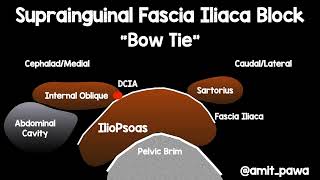 Suprainguinal fascia iliaca nerve block anatomy