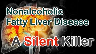 Nonalcoholic Fatty Liver Disease - A Silent Killer You Should Never Ignore |Causes| Symptoms