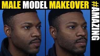 Male Model Makeover®  #18 | Male Plastic Surgery | Dr. Douglas Steinbrech