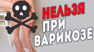 Что нельзя делать при варикозе?