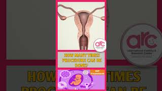 IVF/ICSI சோதனைக்குழாய் சிகிச்சை || ARC Fertility Hospitals