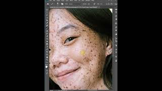 remove freckle in photoshop