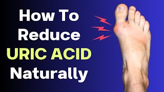 How To Reduce Uric Acid Naturally | VisitJoy