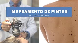 Mapeamento de Pintas e Dermatoscopia Digital - Como é feito este exame?